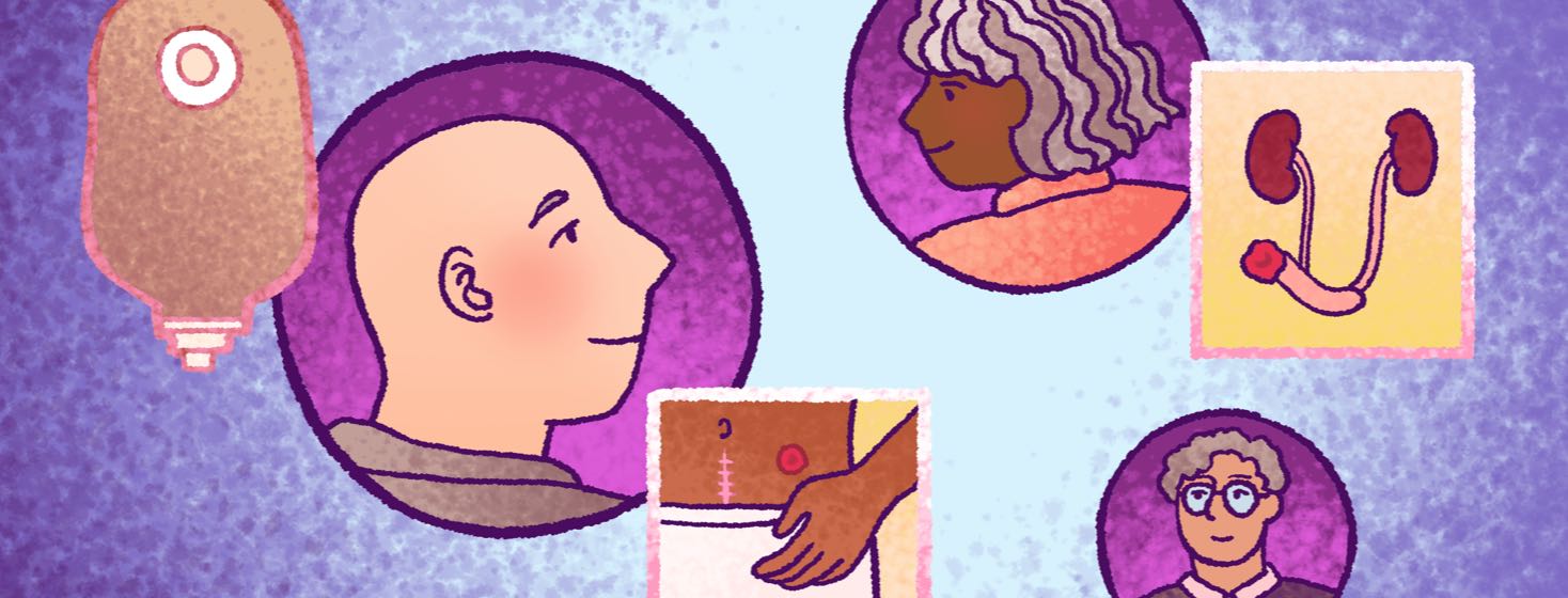 True Life: Living with a Urinary Diversion image